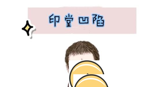 印堂凹陷的男人怎么样 运势好不好？ 印堂凹陷怎么改善