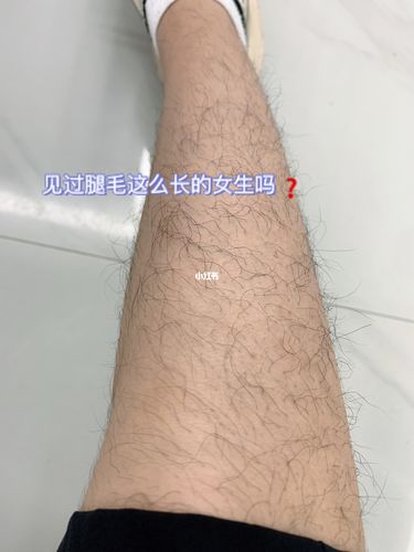 梦见腿毛怎么回事 梦见腿毛有什么预兆 腿毛掉的厉害的原因吗