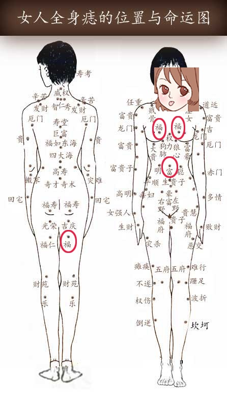 福府痣 逸堂痣好吗