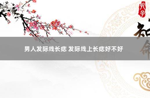 男人发际线长痣 发际线上长痣好不好