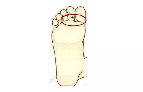 脚趾头长痣代表什么图片