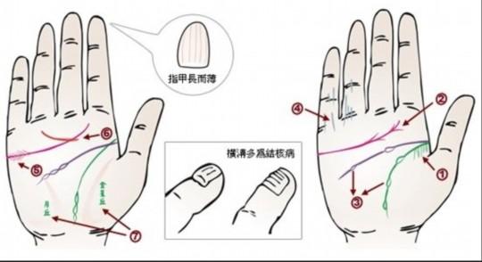 预示身体健康堪忧的三种手纹 不健康的手纹