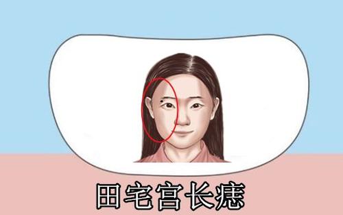 女人少田宅痣部位图图片